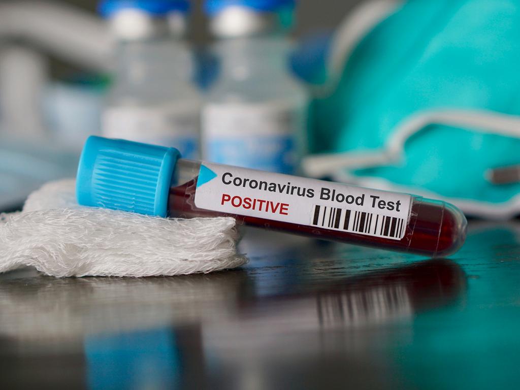 Coronavirus Blood Test